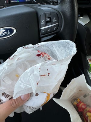 New York woman, 4-year-old daughter find blood on Burger King order